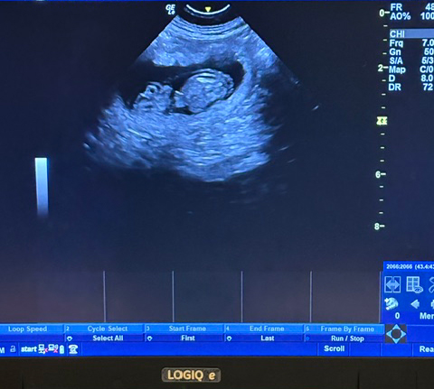 Confirmé – Macha est enceinte